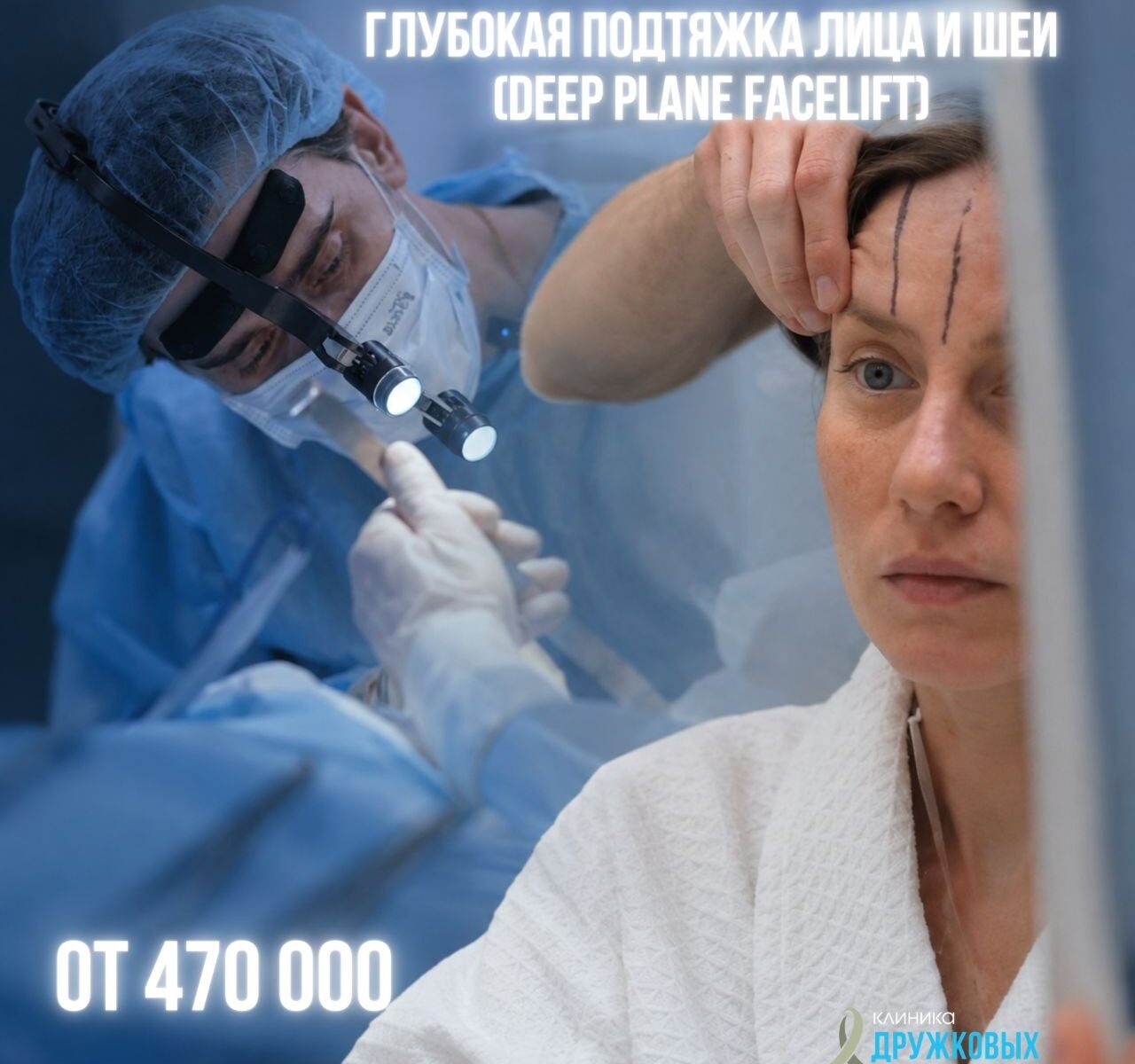 глубокая подтяжка лица казань